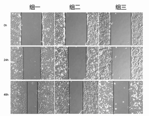 细胞划痕实验的操作步骤及适用范围【附视频教程】