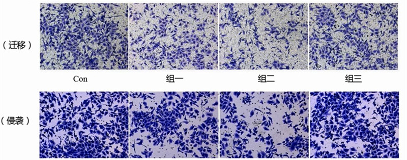 Transwell实验的操作步骤及常见问题【附视频教程】